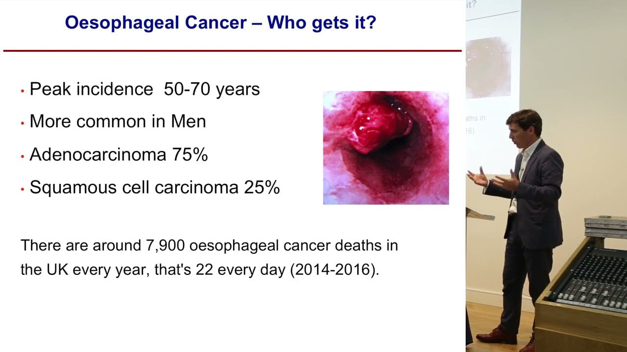 Treatments for Barrett's Oesophagus, Oesophageal Cancer, and other GI Problems