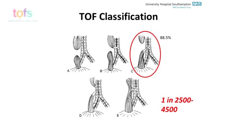 Long-term GI Complications